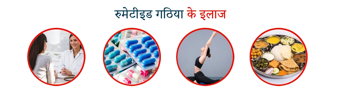 Treatment of Rheumatoid Arthritis in Hindi